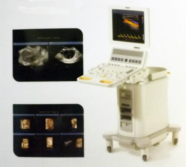 Aparelho de ultrassonografia Philips HD 15 (Foto: Divulgação)