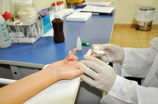 No caso do teste de HIV, a população interessada pode fazer o teste rápido, que fica pronto em menos de 15 minutos. (Foto: Assessoria)