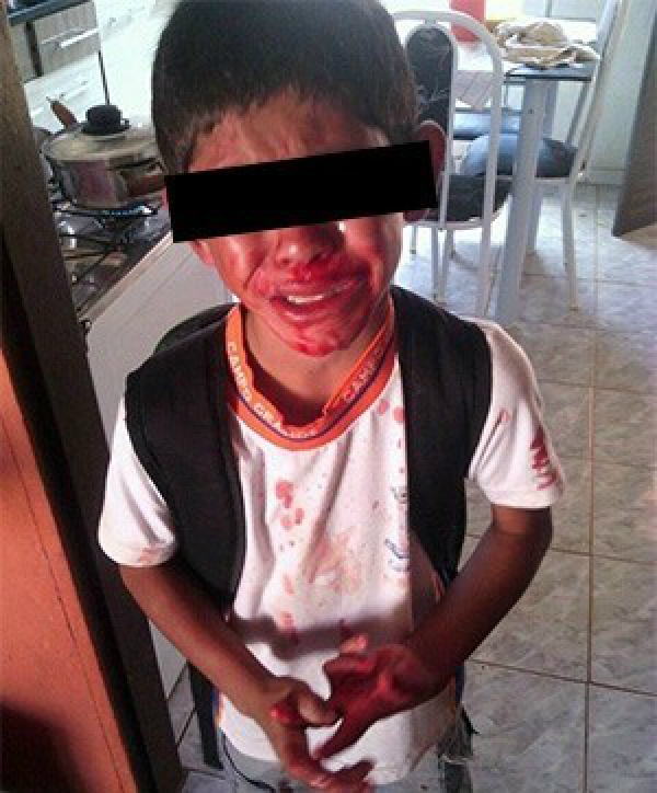 A mãe do aluno afirmou que o filho chegou em casa por volta das 11 horas, com o rosto lesionado e sangrando muito (Foto: Divulgação)