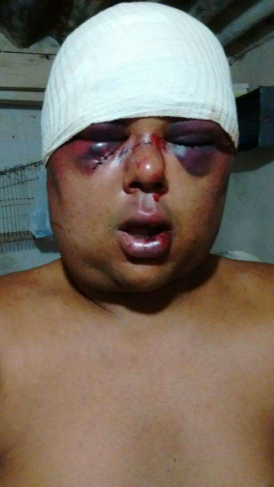 ‘’Saímos para matar veado’’, diziam agressores de homossexual em Três Lagoas Caio logo após o espancamento na terça-feira (10). (Foto: Arquivo pessoal).