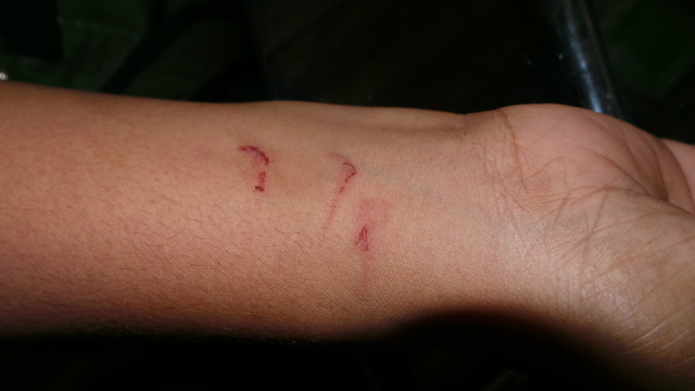 A funcionária disse que foi agredida por duas colegas de trabalho, mostrando alguns arranhões no braço direito (Foto: Ricardo Ojeda)