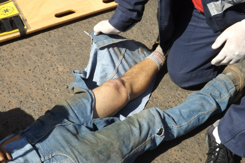 A vítima, possivelmente, teve o joelho esquerdo fraturado, após o violento impacto contra o carro (Foto: Edivelton Kologi)
