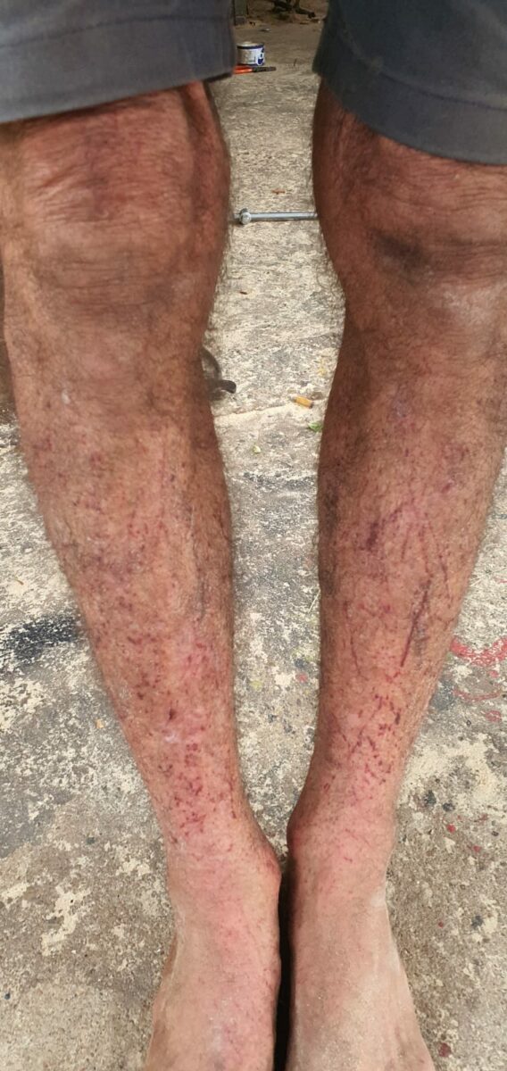 Em Três Lagoas homem é atacado por felino durante caminhada Em Três Lagoas homem é atacado por felino durante caminhada