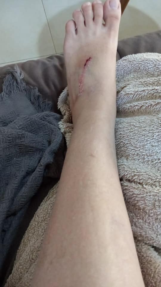 Violentamente espancada pelo marido, enfermeira passa noite de horror em Três Lagoas