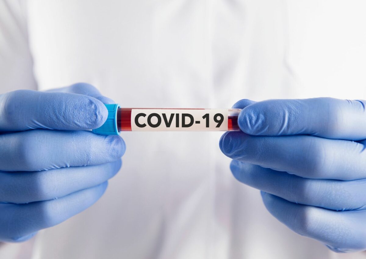Covid-19: Brasil registra 482 novos casos e 9 mortes em 24 horas