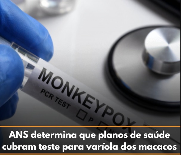 ANS determina que planos cubram teste para varíola dos macacos