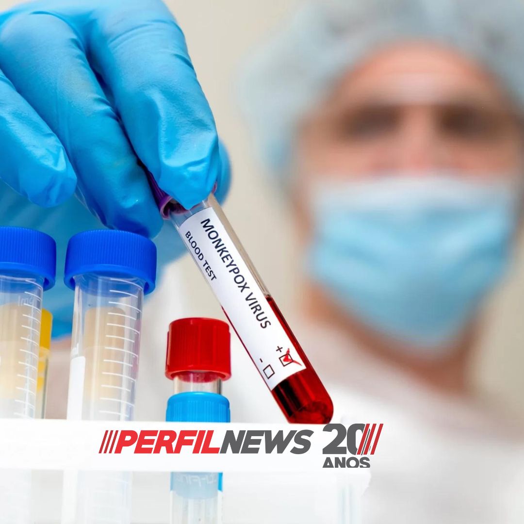 Brasil tem oitava morte por varíola dos macacos confirmada