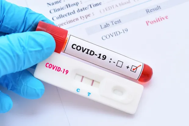 Covid-19: Brasil registra 482 novos casos e 9 mortes em 24 horas