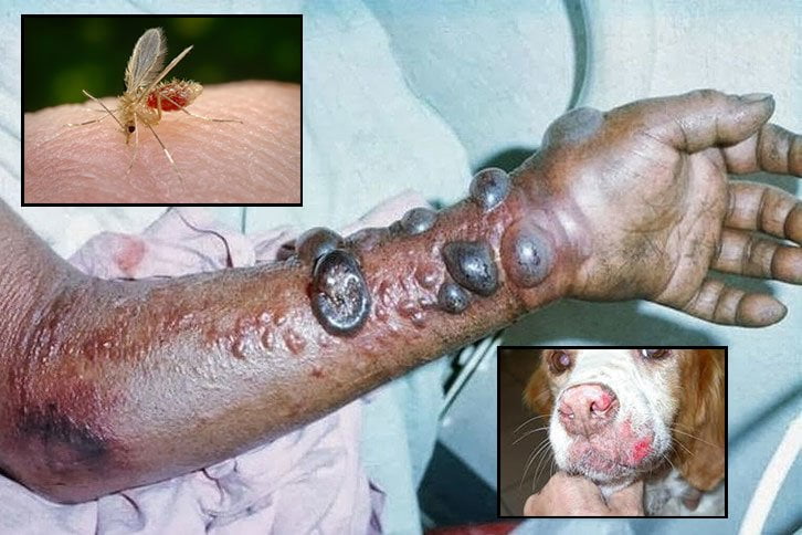 Boletim da dengue aponta queda de casos nesta semana em Três Lagoas