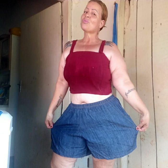 Doméstica de Três Lagoas emagrece 80 kg e pede ajuda para remover excesso de pele Doméstica de Três Lagoas emagrece 80 kg e pede ajuda para remover excesso de pele