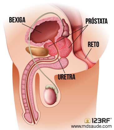 Prevenção é a melhor alternativa para contra o câncer de próstata que mata milhares de homens todos os anos