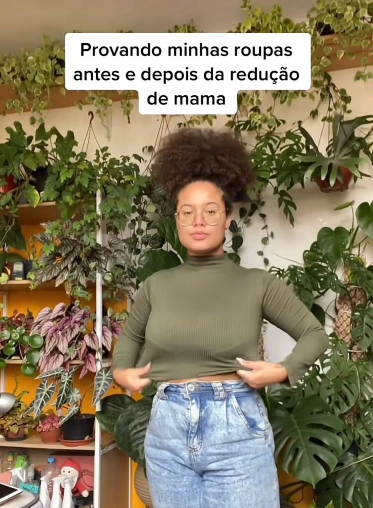 Cirurgias de redução de mama viralizam no Tiktok