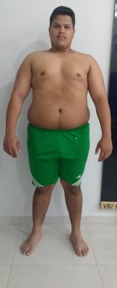 No Dia Mundial da Obesidade, importância é lembrar de construir hábitos saudáveis de forma sustentável