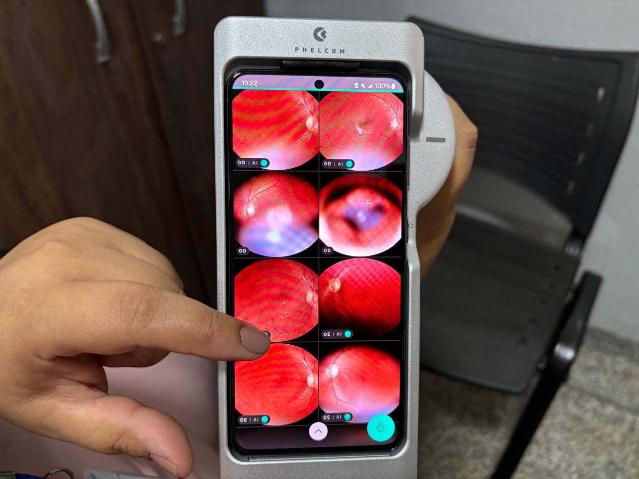 Retinógrafos portáteis: Governo de MS avança na saúde digital com telediagnóstico em oftalmologia Retinógrafos portáteis: Governo de MS avança na saúde digital com telediagnóstico em oftalmologia