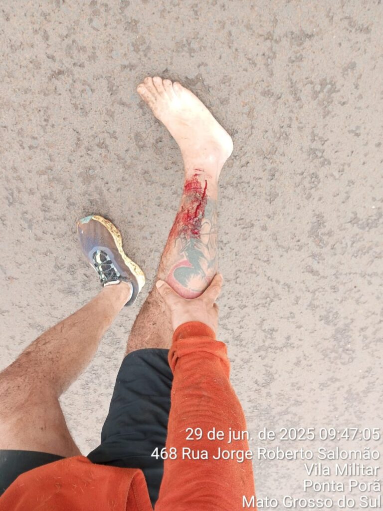 Perigo nas Ruas: Mestre de Muay Thai é atacado por dois pitbulls em Ponta Porã e faz alerta à população Perigo nas Ruas: Mestre de Muay Thai é atacado por dois pitbulls em Ponta Porã e faz alerta à população