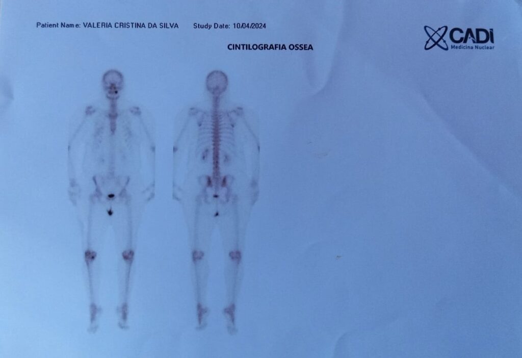 Com dores 24h, radialista três-lagoense faz Vakinha para tratar fibromialgia