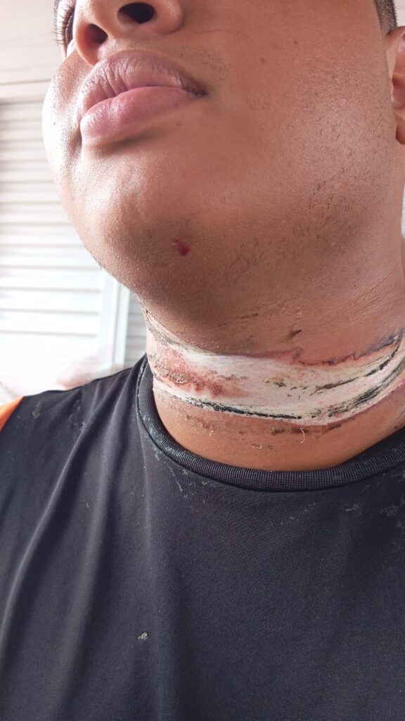 Por pouco, motociclista não é enforcado por cabos de internet soltos na Rosário Congro