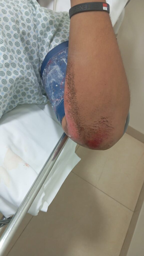 Por pouco, motociclista não é enforcado por cabos de internet soltos na Rosário Congro