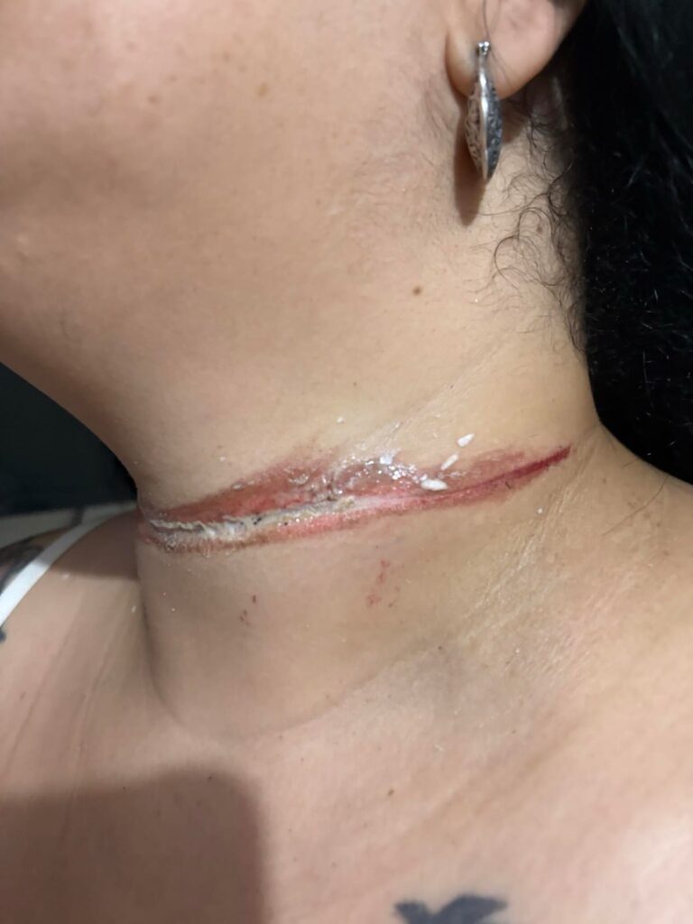 Professora quase é enforcada por cabos de internet em Três Lagoas Professora quase é enforcada por cabos de internet em Três Lagoas