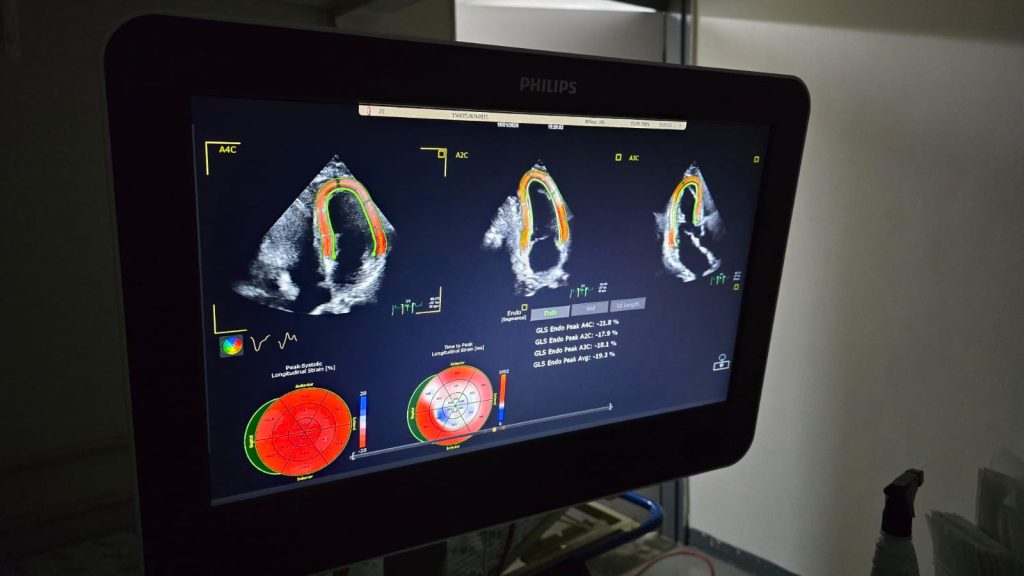 Novo ecocardiograma garante diagnósticos mais precisos, inclusive para prematuros, no HRMS Novo ecocardiograma garante diagnósticos mais precisos, inclusive para prematuros, no HRMS