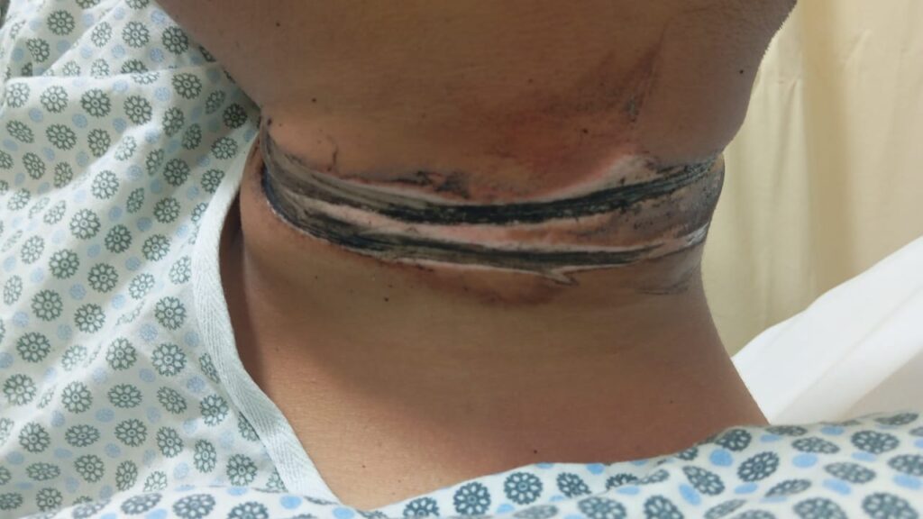 Fios soltos colocam vidas em perigo e revelam descaso com a infraestrutura de Três Lagoas