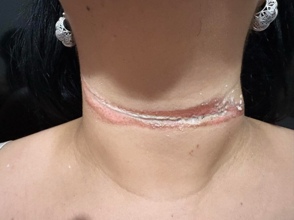 Fios soltos colocam vidas em perigo e revelam descaso com a infraestrutura de Três Lagoas