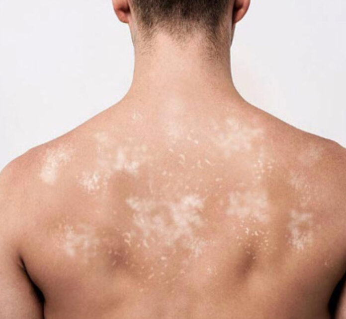 unnamed - 2026-03-23T151115.600