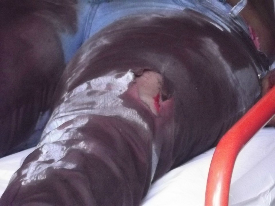 Marido mata mulher a facadas em Três Lagoas