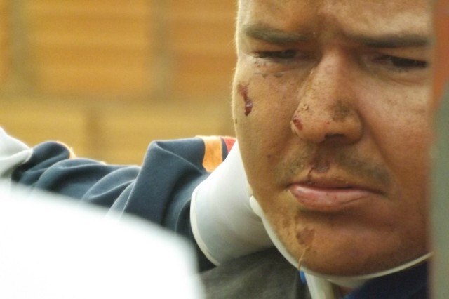 Pedreiro cai de andaime e sofre ferimentos no rosto e braços Pedreiro cai de andaime e sofre ferimentos no rosto e braços