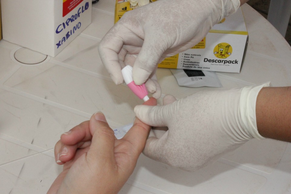 Casos de HIV identificados neste ano ultrapassam registros de 2013