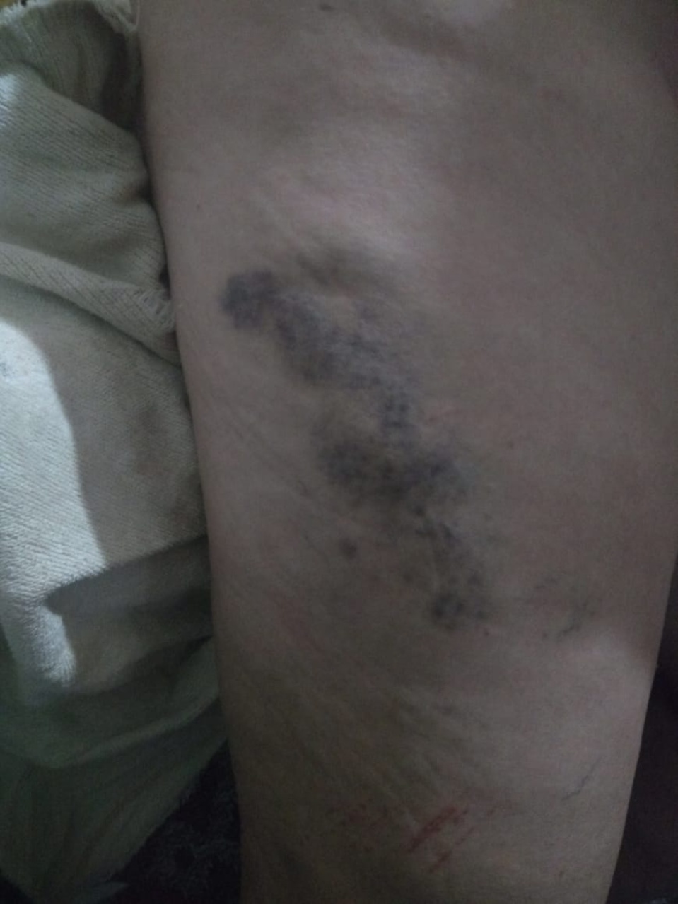 Idosa de 72 anos e o filho são agredidos por suposto autor que divulgou video de sexo em Três Lagoas Idosa de 72 anos e o filho são agredidos por suposto autor que divulgou video de sexo em Três Lagoas