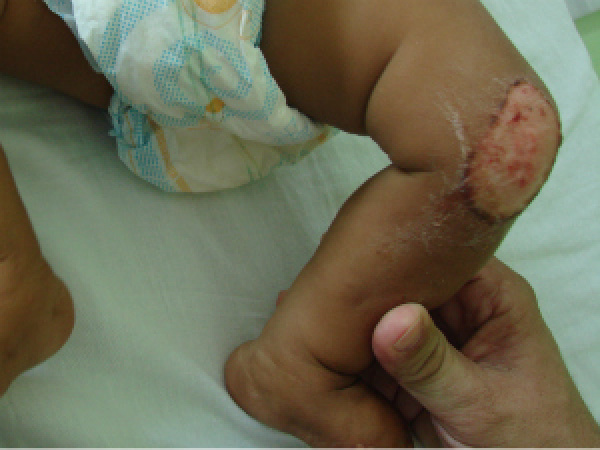 Lesão no joelho do bebê de 6 meses
Foto: Divulgação/Polícia Civil