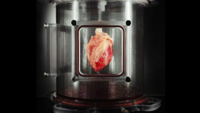 Cientistas do Massachusetts General Hospital e da Harvard Medical School conseguiram criar um coração híbrido, feito em parte por células tronco. (Foto: Divulgação/Superinteressante)