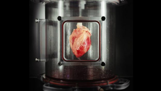 Cientistas recriam coração humano a partir de células tronco Cientistas do Massachusetts General Hospital e da Harvard Medical School conseguiram criar um coração híbrido, feito em parte por células tronco. (Foto: Divulgação/Superinteressante)
