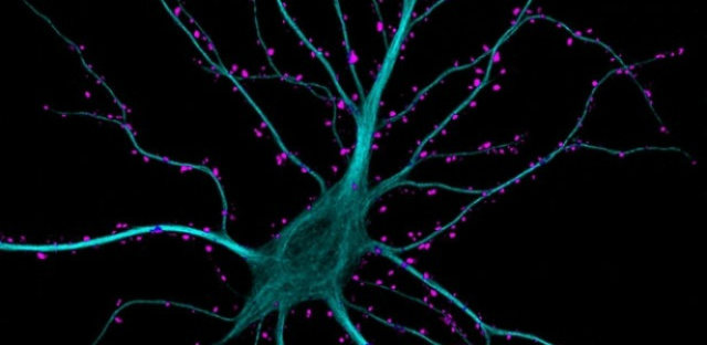 Memória perdida por Alzheimer pode ser recuperada, diz estudo Estimulando áreas específicas do cérebro com luz azul, os cientistas podem conseguir que os animais lembrem experiências às quais não conseguiam ter acesso antes (Foto: Divulgação)