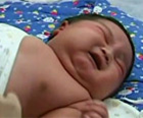 Bebê mais gordo do mundo, nasceu na China
Foto: G1
