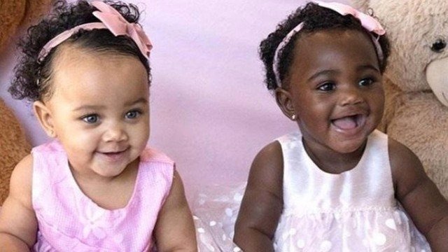 Gêmeas com cor de pele diferente fazem sucesso na web Clique das gêmeas mais novas Foto: Reprodução / Instagram