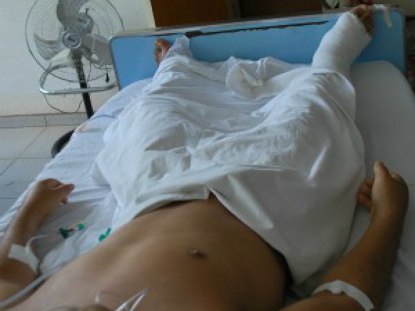 Trabalhador ferido em frigorífico tem a perna amputada, diz hospital de MS Vítima antes da cirurgia para amputação das
pernas
Foto: Divulgação/Santa Casa