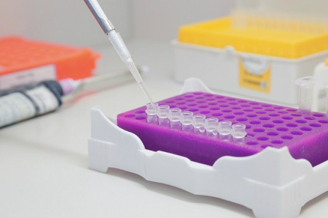 Reagentes do teste estão em produção e serão distribuídos para centros de pesquisa e laboratórios do País (Foto: Divulgação/Fiocruz)
