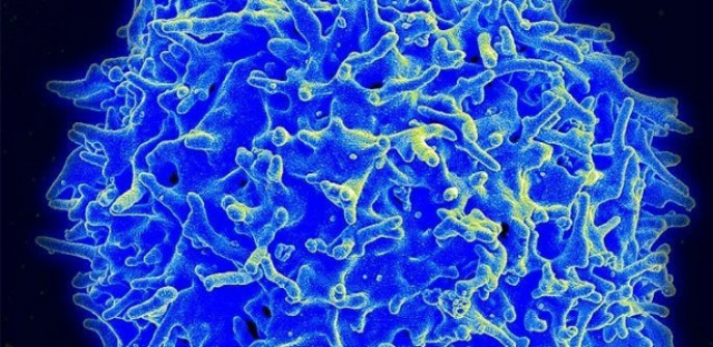 Micrografia de uma célula T (Foto: Reprodução/UOL)