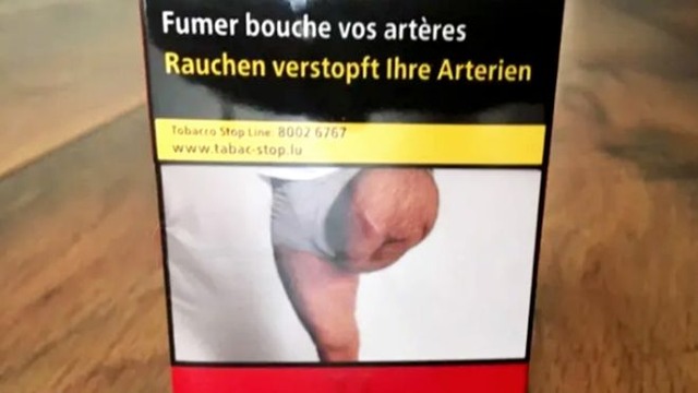 Homem descobre foto da própria perna amputada em pacote de tabaco ANTOINE BARÈGE, RADIO FRANCE