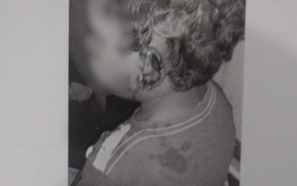 Menino de 4 anos que teve a orelha cortada e foi agredido — Foto: Reprodução/Polícia Civil

