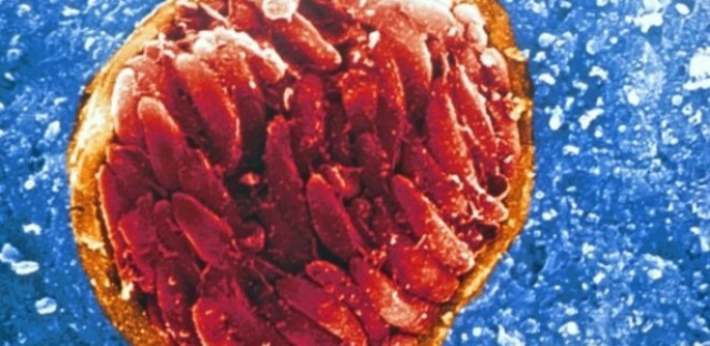 Pesquisa liga comportamento agressivo a parasita no cérebro Adultos com IED mostraram propensão duas vezes maior de infecção em estudo (Foto: Universidade de Chicago)