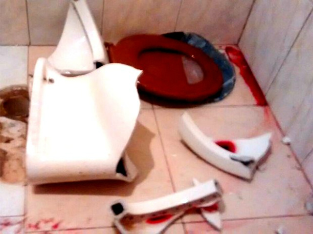 Criança caiu em cima de vaso sanitário (Foto: Blog do Experidião/Divulgação)