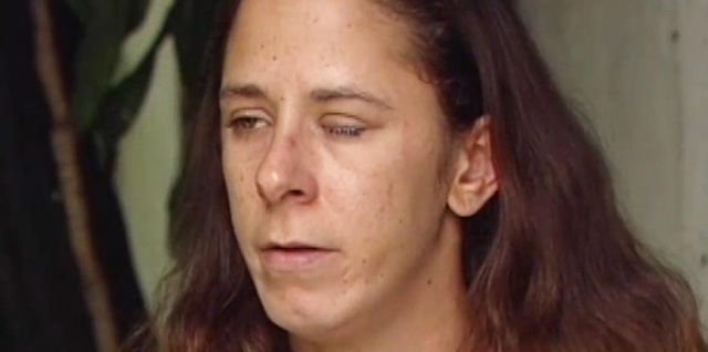 Mulher fica com olho grudado após amigo pingar supercola em vez de colírio Katherine Gaydos temporariamente com apenas uma vista | Reprodução/Twitter(People Magazine)
