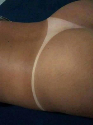 Marquinha do bronze ajuda “apimentar” o casamento, diz especialista Veja como fica a marca do bronze na pele após a sessão bronzeamento (Foto: Divulgação)