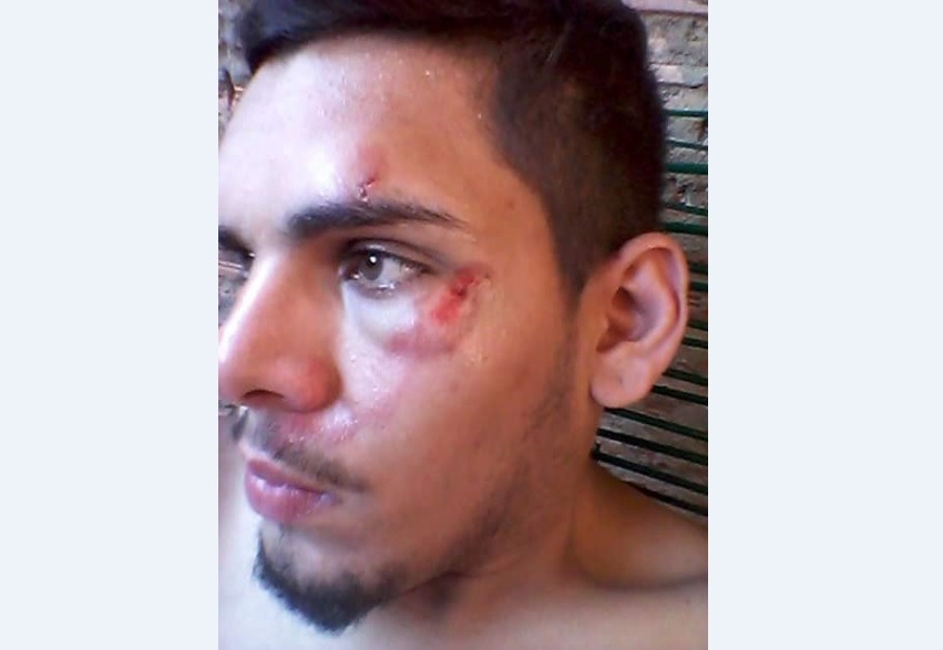 Homem sofre ferimentos no rosto após tentativa de assalto em frente à Praça Ramez Tebet Otávio ficou com o rosto bem machucado devido à tentativa de assalto. Foto: Reprodução Facebook.