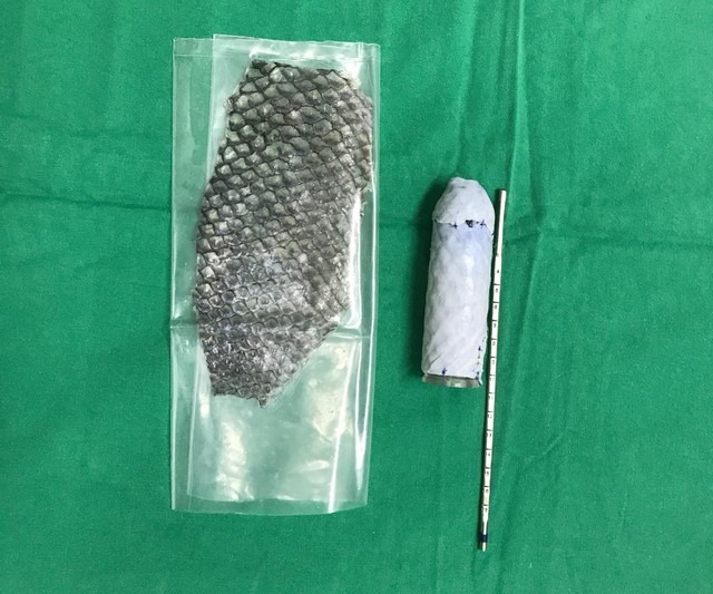 Pele em embalagem estéril e, à direita, montada em molde vaginal (Foto: Leonardo Bezerra/Arquivo pessoal)