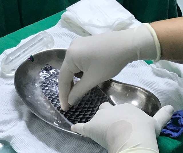 Pele de tilápia sendo preparada no intraoperatório (Foto: Leonardo Bezerra/Arquivo pessoal)