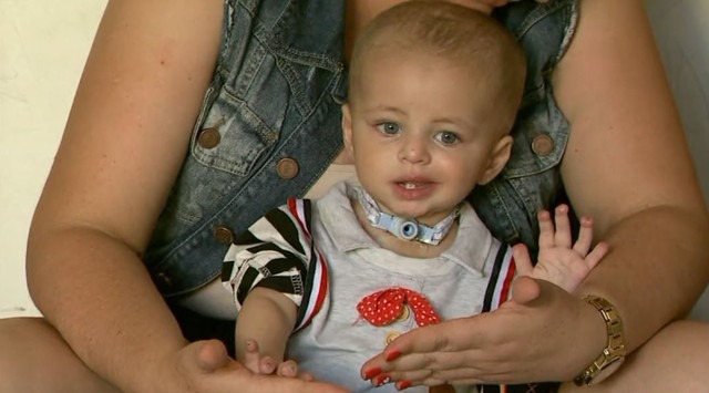 Miguel, de 1 ano, teve extremidades dos dedos e pé esquerdo amputado após ser atendido na Santa Casa de Franca, SP (Foto: Reprodução/EPTV)